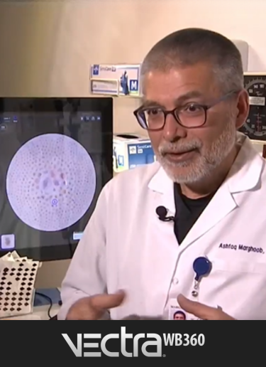 Dr. Ashfaq A. Marghoob Discusses VECTRA® WB360 at Memorial Sloan Kettering Cancer Center with NBC News
