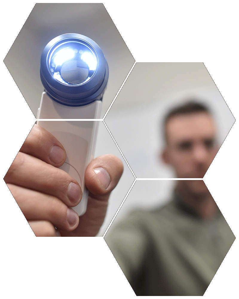 Dermatoscope production