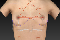 Automated measurements,