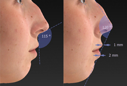 Detailed Facial Diagrams and Measurements