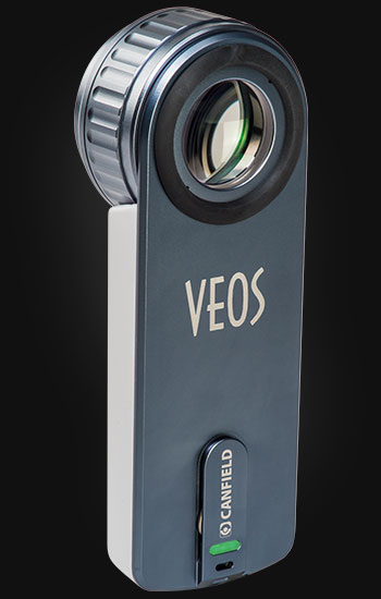 VEOS HD2