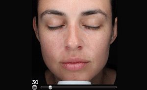 simulação
avançada de idade