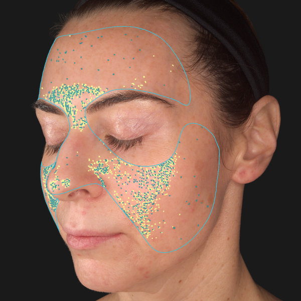 Advanced Skin Analysis - Texture