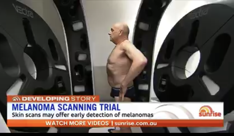 Canfield’s VECTRA® WB360 featured on Seven Network’s Sunrise morning show considered a “major breakthrough” in melanoma surveillance 
