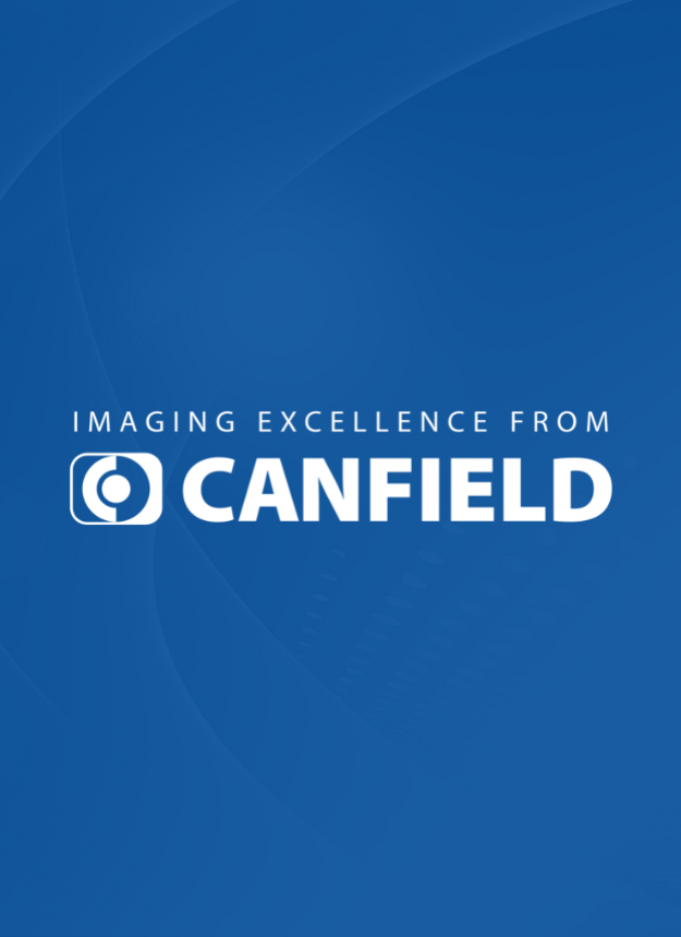 National Innovation Day With Canfield Scientific