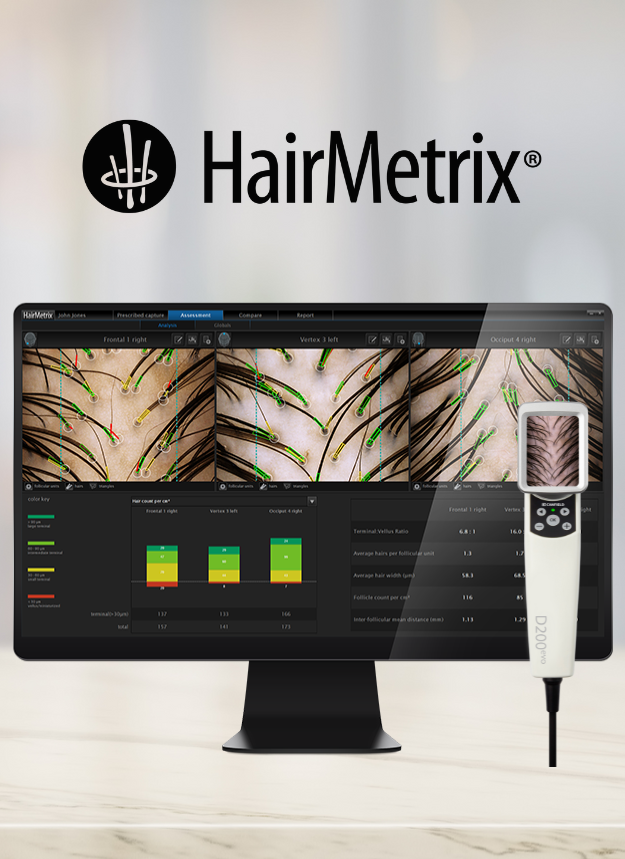 Canfield’s Advanced AI-Driven Hair Consultation Solution: HairMetrix® 