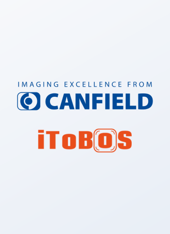 Canfield Scientific is Working with iToBoS to Develop Next Generation Artificial Intelligence