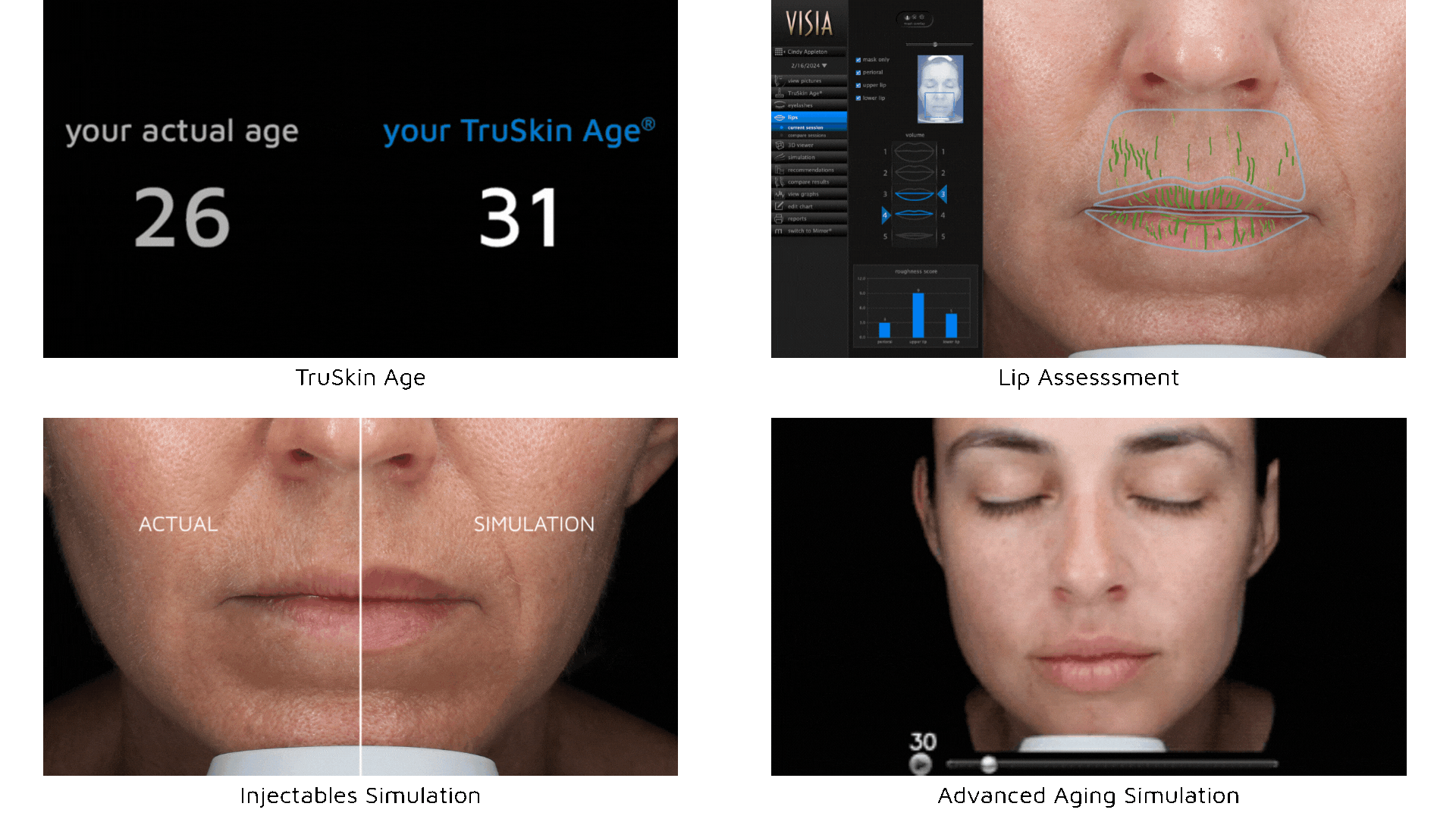 Visia Wins Best Imaging Device In Medesthetics Readers Choice Awards ...