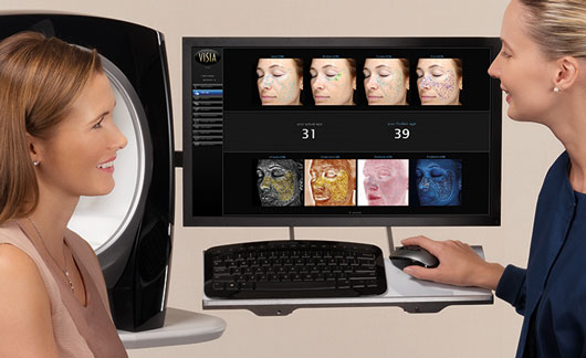 VISIA Complexion Analysis System