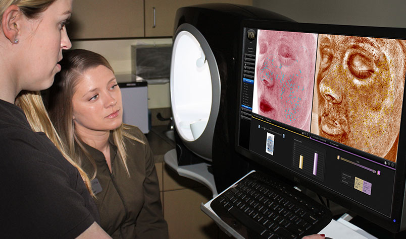 VISIA helps show patients the extent of their skin damage
