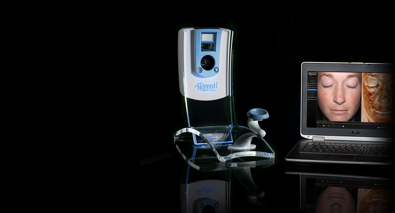 Reveal® Imager